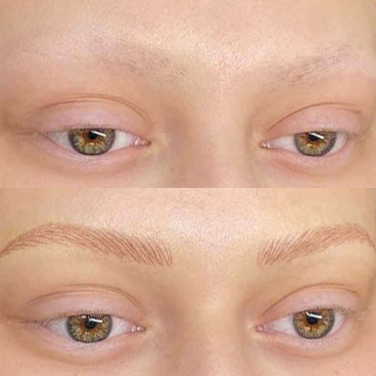 microblading-cancer-3