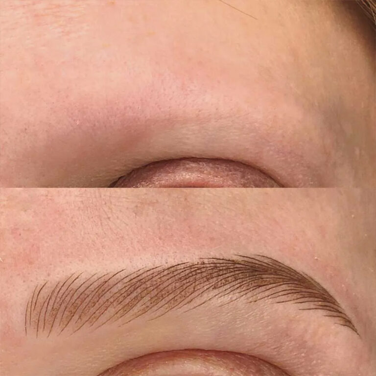 microblading-cancer